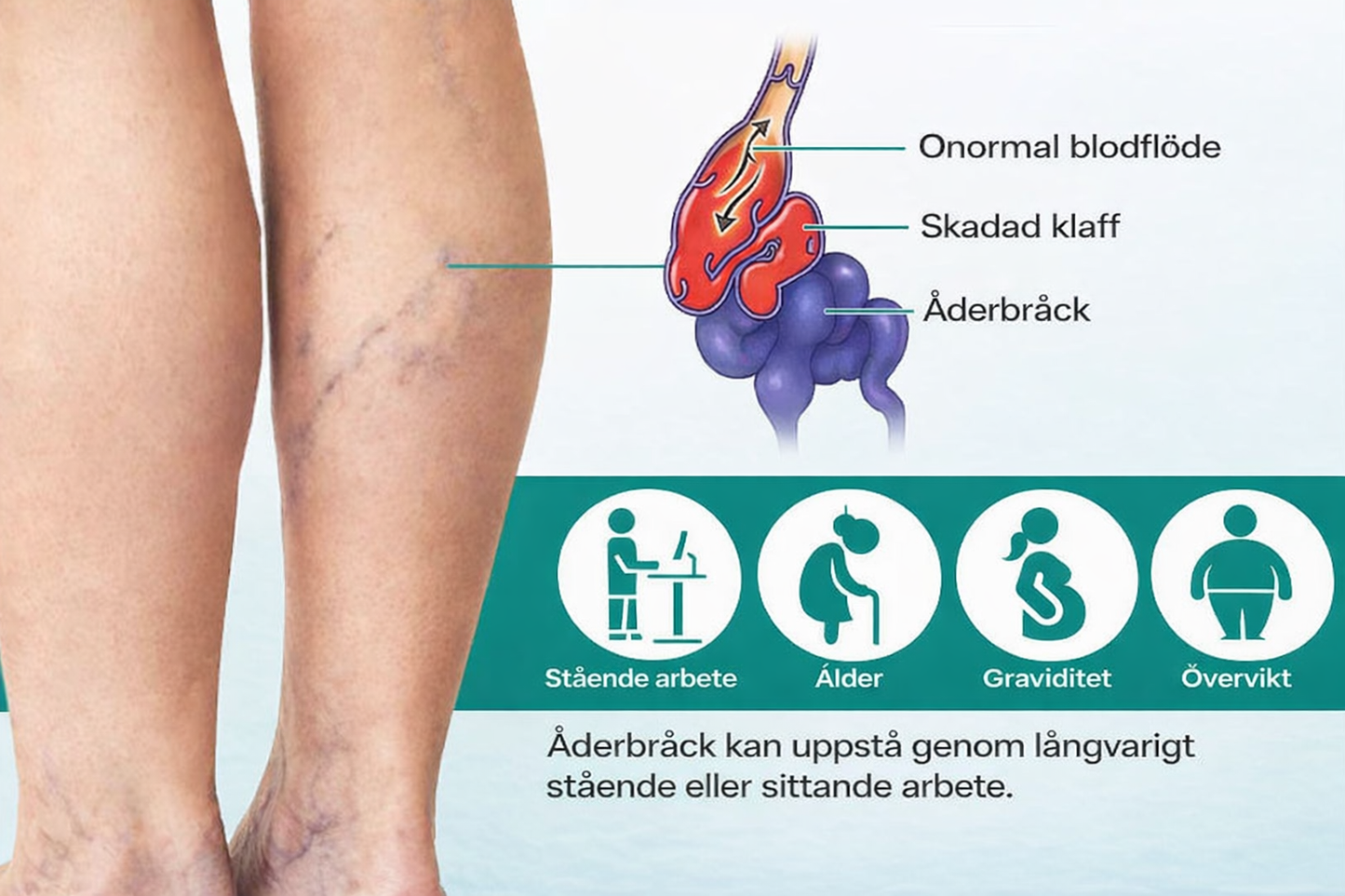 VenaLindra™ – Mikronålsplåster för stöd av vener och lindring av tunga ben