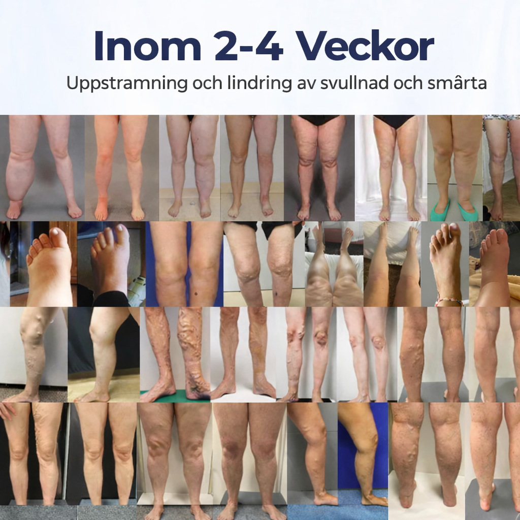 BenRo™ – Lindrande benkräm för lättare ben och bättre blodcirkulation