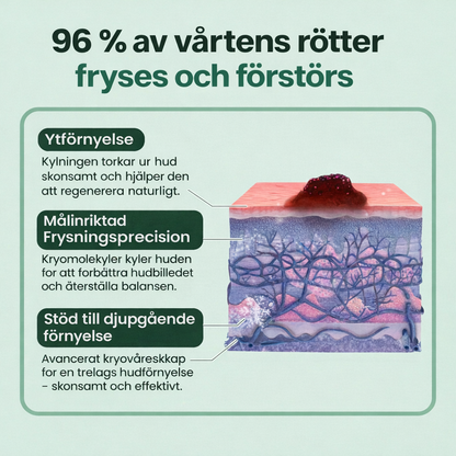 HudKlar™ ChillErase – Precisionskylande spray för slätare hud
