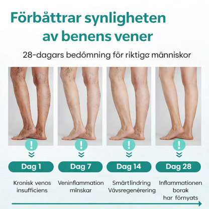 VenaLindra™ – Mikronålsplåster för stöd av vener och lindring av tunga ben