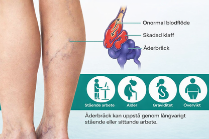 VenaLindra™ – Mikronålsplåster för stöd av vener och lindring av tunga ben