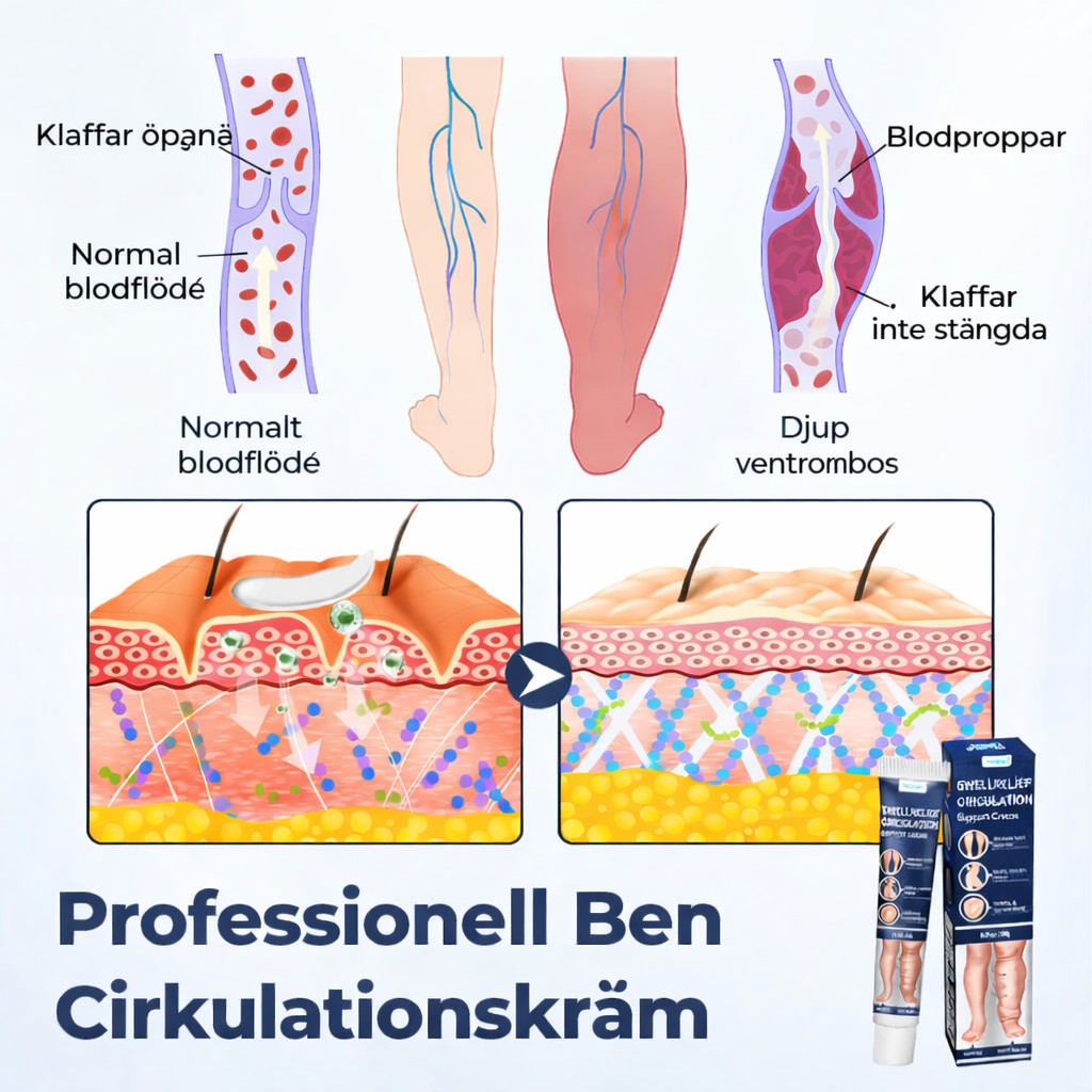 BenRo™ – Lindrande benkräm för lättare ben och bättre blodcirkulation