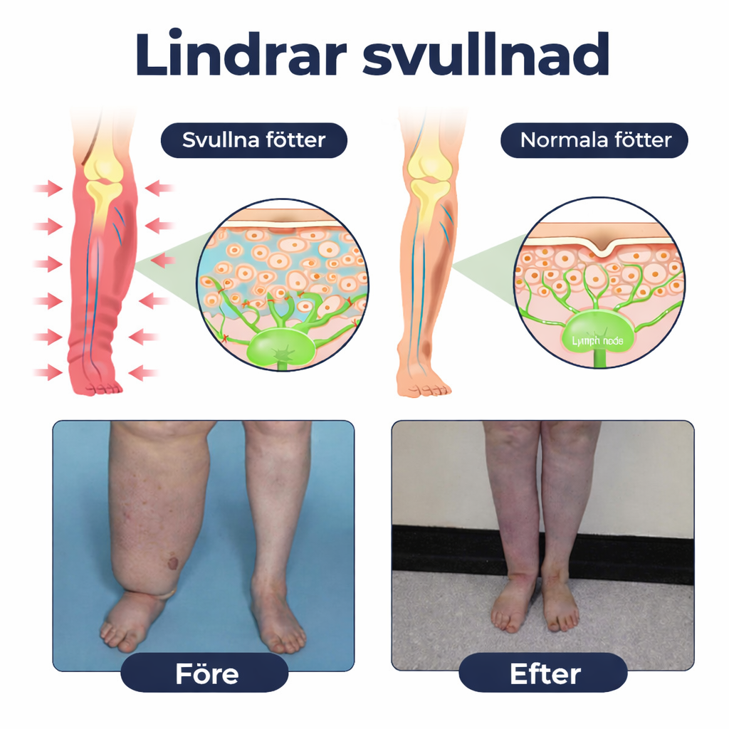 BenRo™ – Lindrande benkräm för lättare ben och bättre blodcirkulation