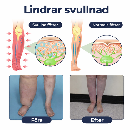 BenRo™ – Lindrande benkräm för lättare ben och bättre blodcirkulation