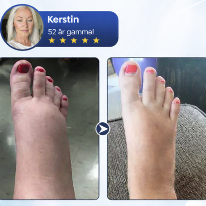 BenRo™ – Lindrande benkräm för lättare ben och bättre blodcirkulation