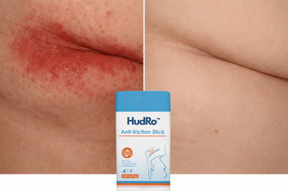 HudRo™ – Anti-friktionsstick för irriterad hud