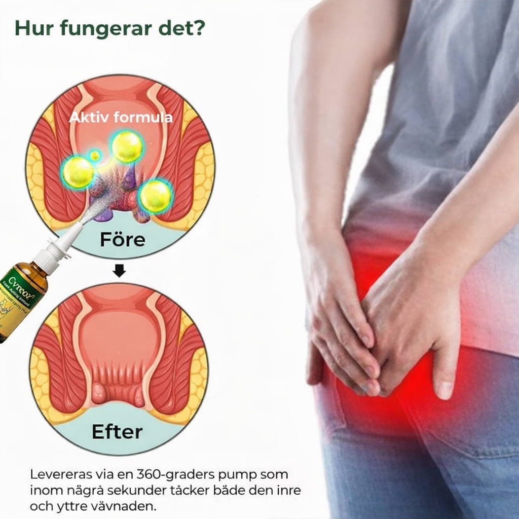 HaemoLind™ – Snabbverkande, örtbaserad spray mot hemorrojder