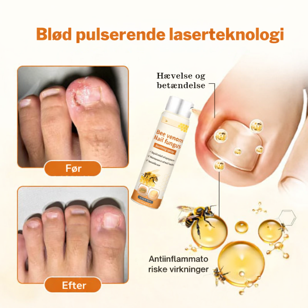 KlarNagel™ – Avancerad Svampdödande Nagelvårdsspray