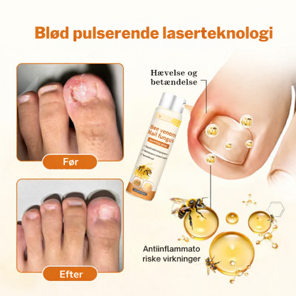 KlarNagel™ – Avancerad Svampdödande Nagelvårdsspray