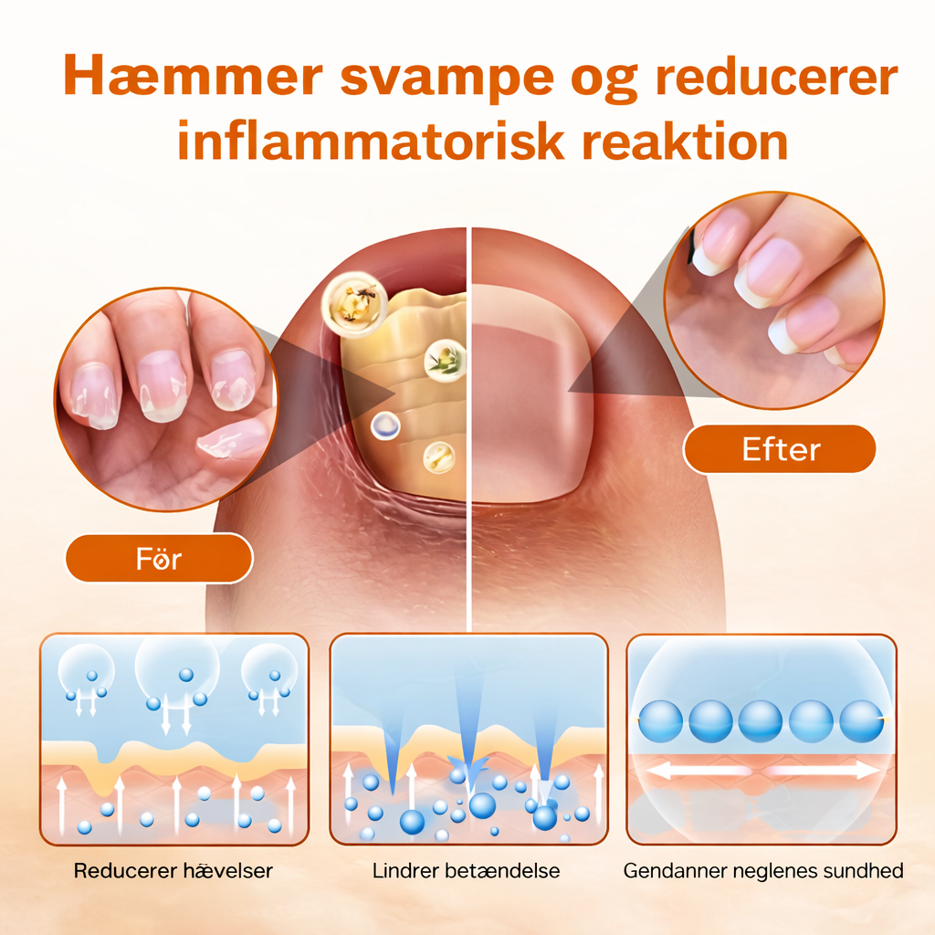 KlarNagel™ – Avancerad Svampdödande Nagelvårdsspray