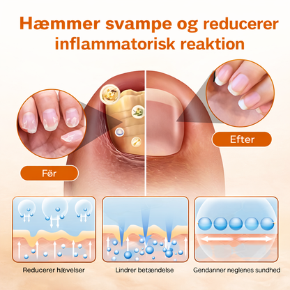 KlarNagel™ – Avancerad Svampdödande Nagelvårdsspray