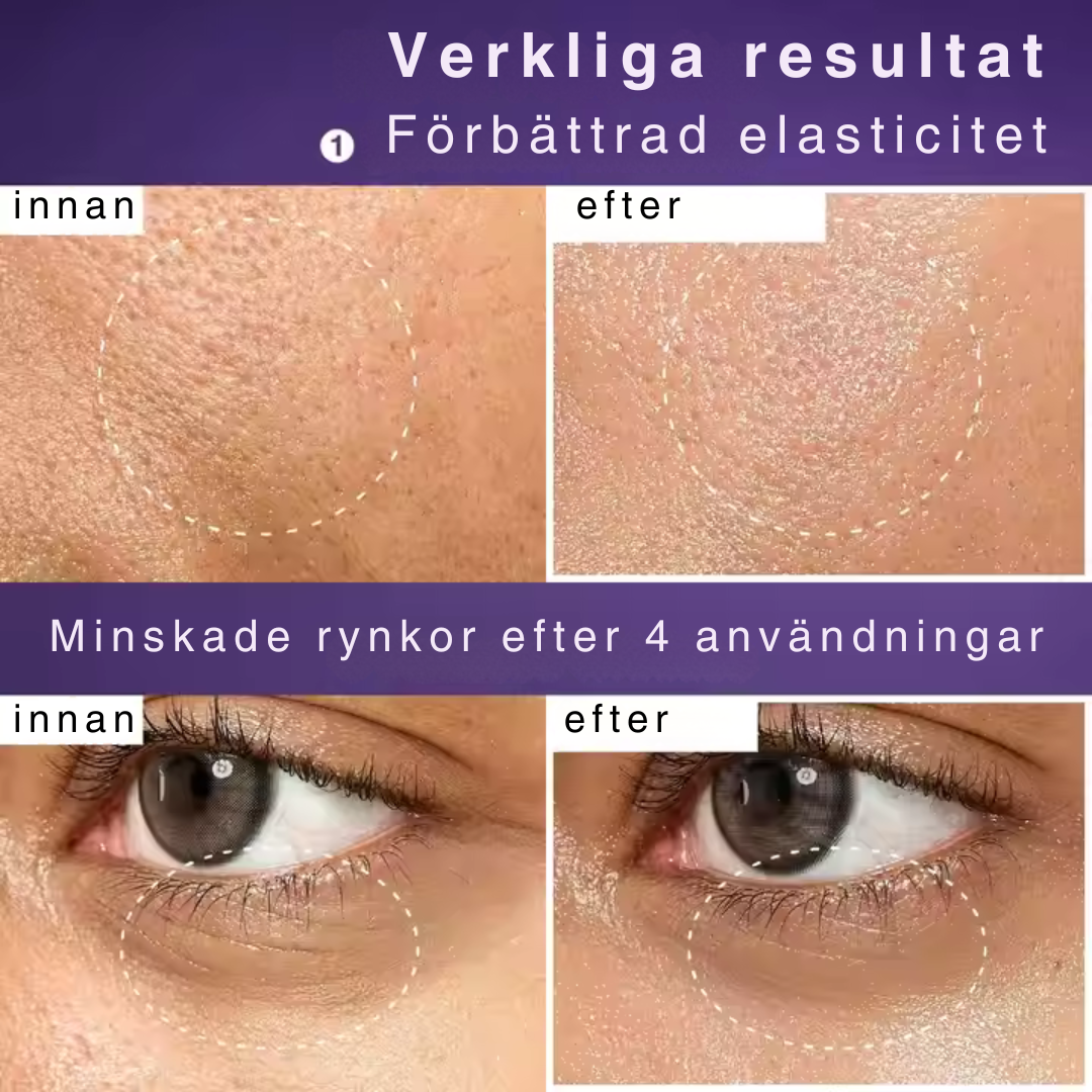 HudKlar™ –  NAD+ Lyftserum & Mask